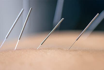 Acupuntura